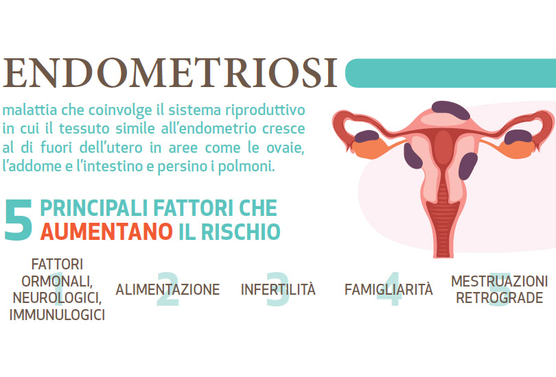 endometriosi dieta